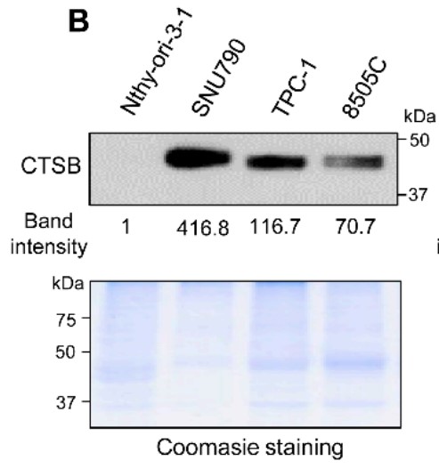 Western blot of secreted CTSB levels in conditioned media of cultured thyroid cancer cell lines (top).jpg